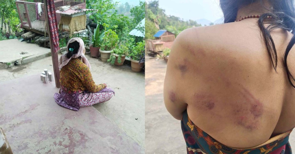 बोक्सी झर्न भन्दै महिलामाथि निर्घात कुटपिट